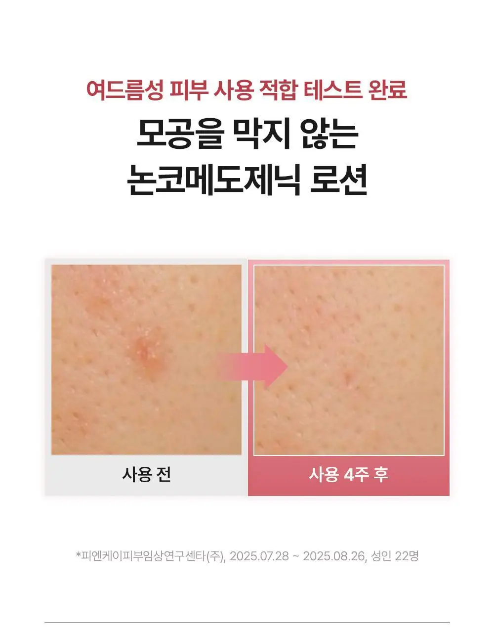 [NEW 화잘먹 피부 밀착 로션] 아렌시아 레드 스무디 로션 5 200ml 상세페이지 12